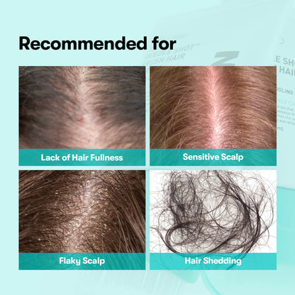 PDRN Reedle Shot Hair Serum